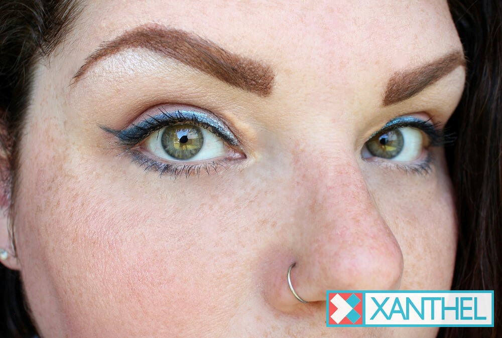 Uncovering the Root - What Triggers Xanthelasma Formation?