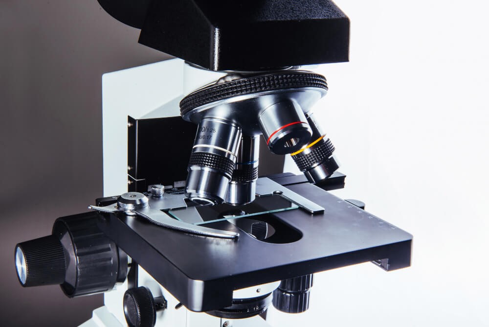 Xanthelasma and Hypothyroidism - Unpacking the Connection